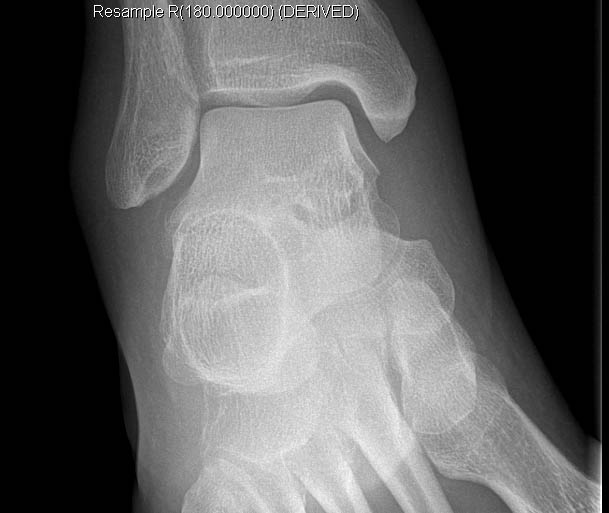 r ankle2.jpg - 51kB